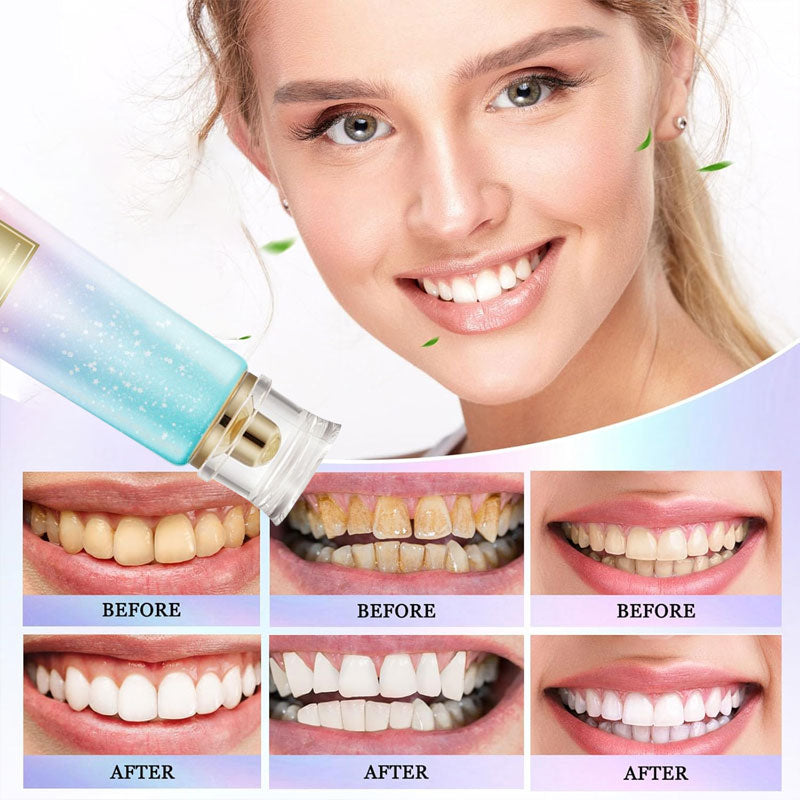 Whitening-Zahnpasta